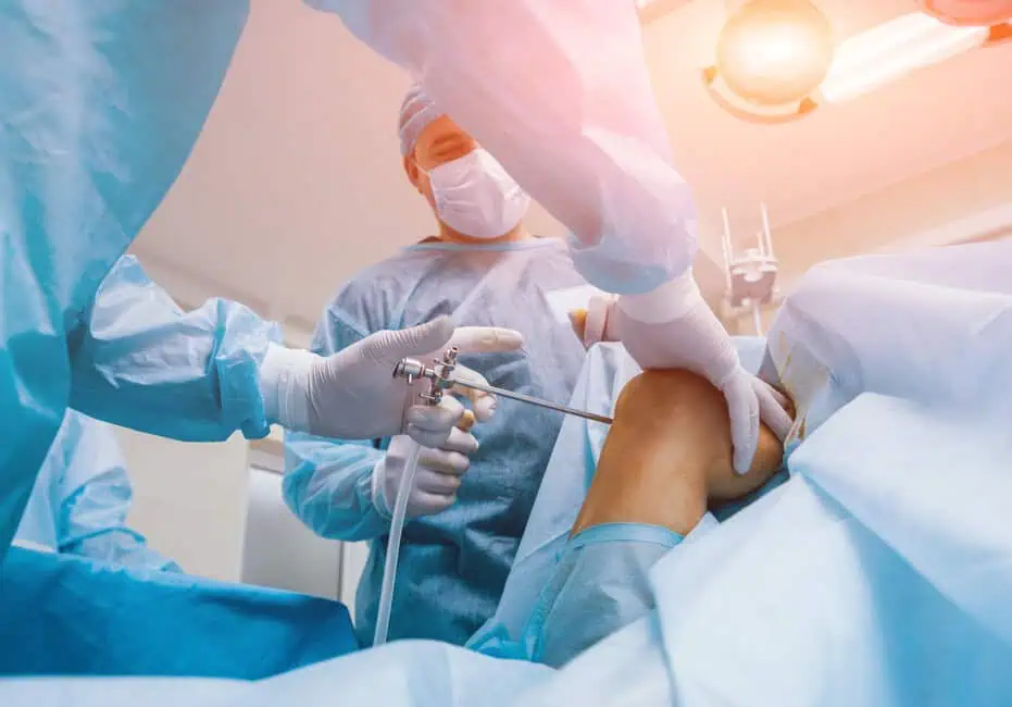 The Benefits of Arthroscopy in Sports Medicine
